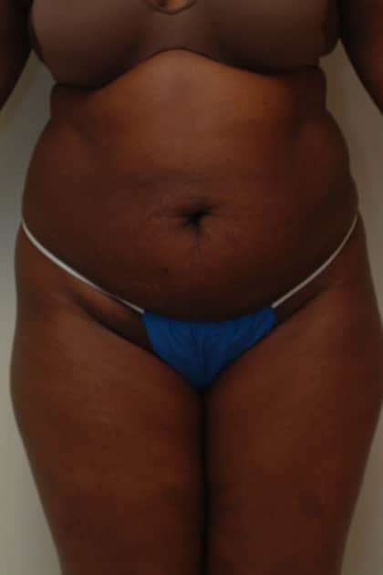 8284 Before Image