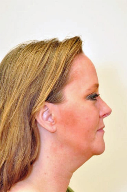 7038-10 Before Image