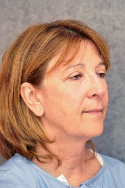 8931-10 Before Image