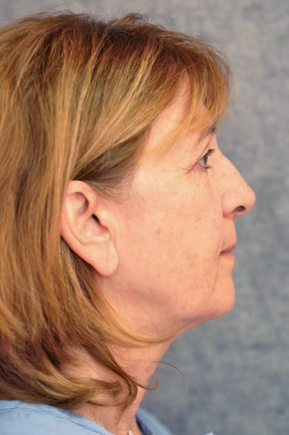 8931-10 Before Image