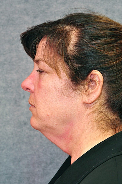 9028-10 Before Image