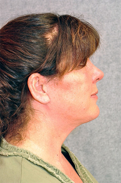 9028-10 After Image