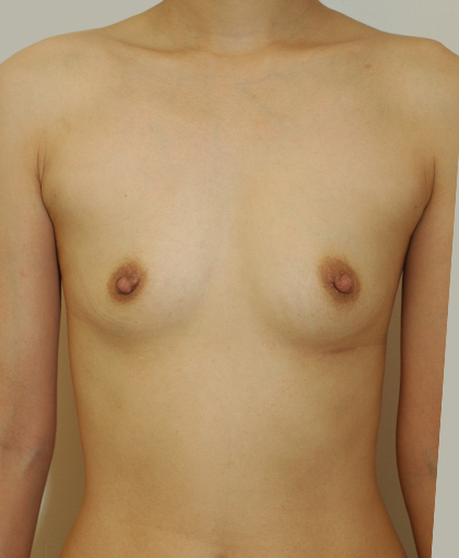 44759 Before Image