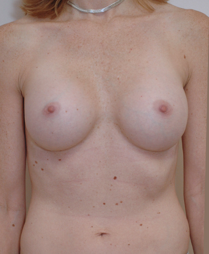 87234 – Draft 4/5 After Image