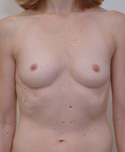 87234 – Draft 4/5 Before Image