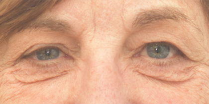 8011 Before Image