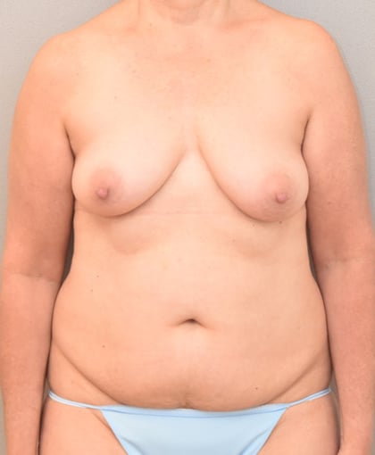 5010 Before Image