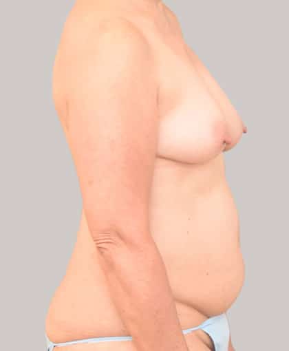5010 Before Image