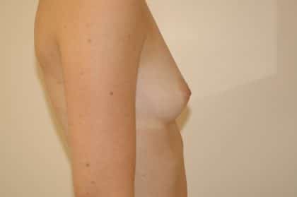 10751 Before Image