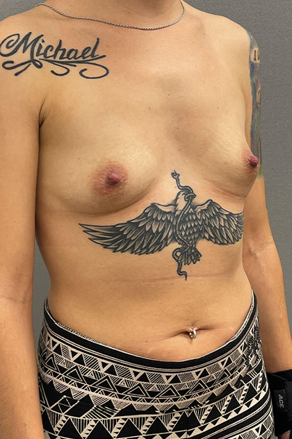 9731-10 Before Image