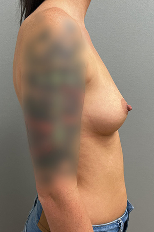 Patient #4774 Before Image