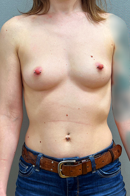 Patient #5651-10 Before Image