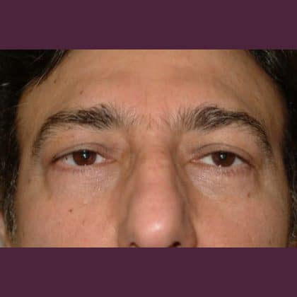 6569 After Image