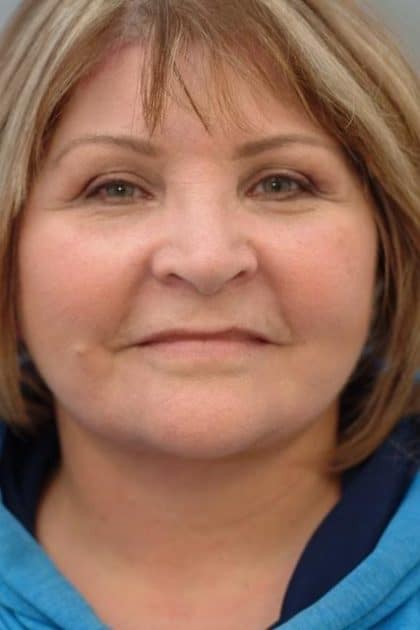 10031-30 After Image