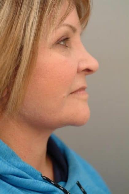 10031-30 After Image