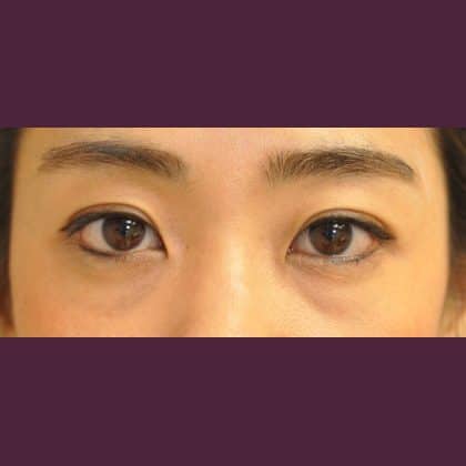 8808 Before Image