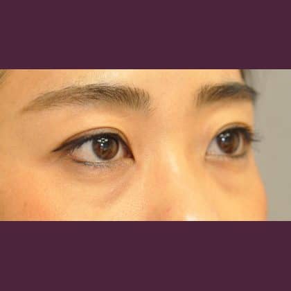 8808 Before Image