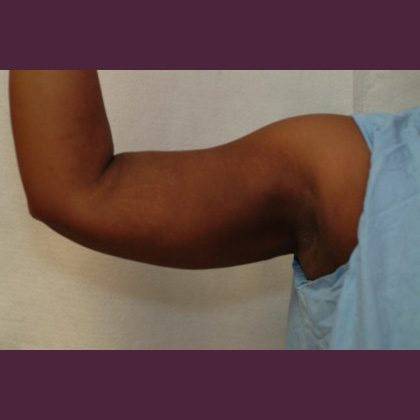 6584 After Image