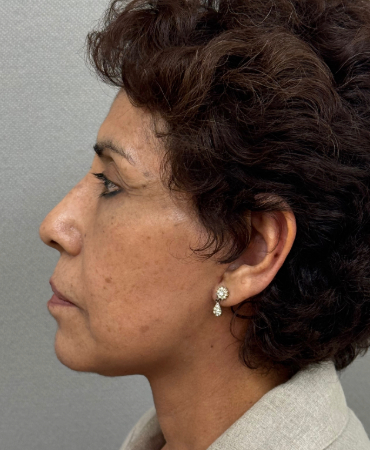 1999-20 After Image