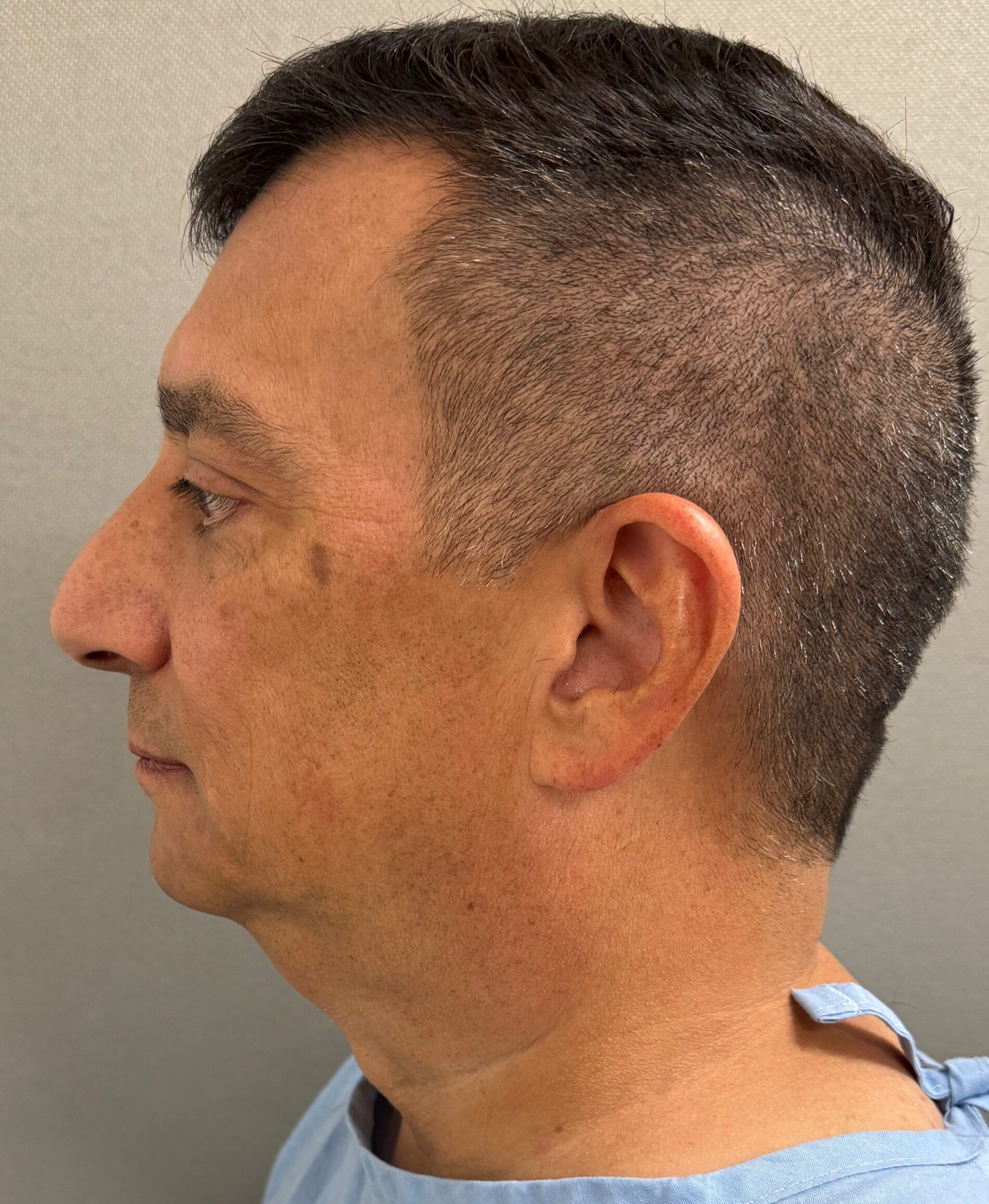 3455-20 Before Image
