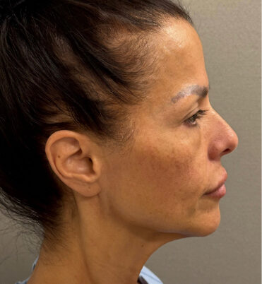 1344-20 Before Image