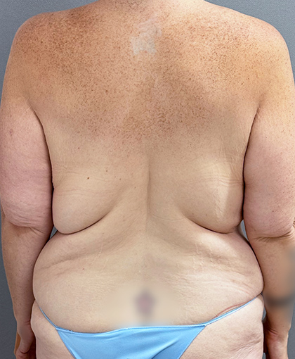 1228-20 Before Image