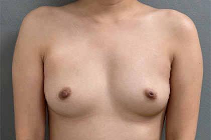 1339-20 Before Image