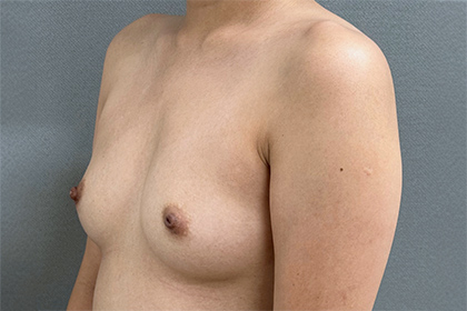 1339-20 Before Image