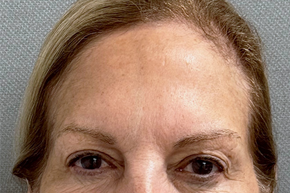 2044-20 Before Image