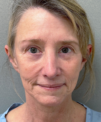 3499-20 Before Image