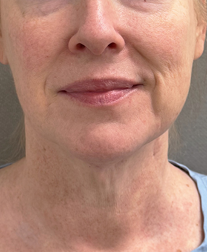 3488-20 Before Image