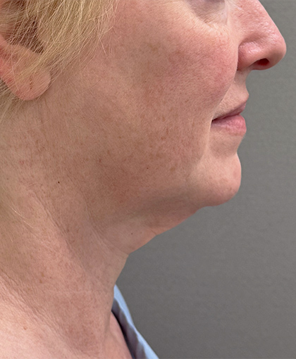 3488-20 Before Image