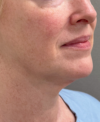 3488-20 Before Image