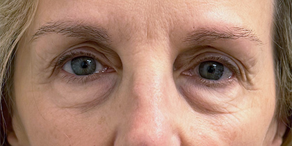 1388-20 Before Image