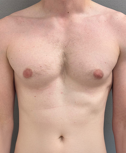 4458-20 Before Image