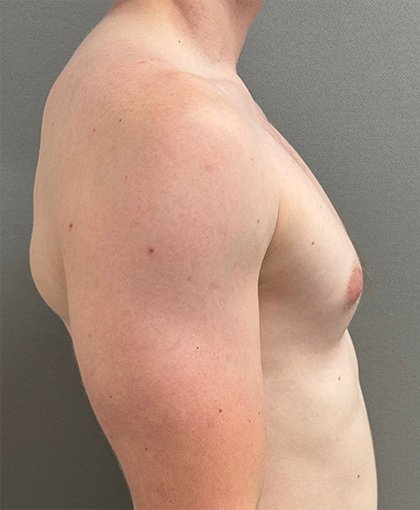 4458-20 Before Image