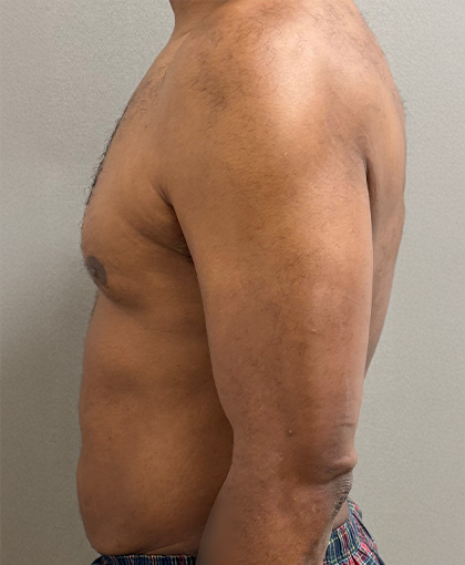 4459-20 Before Image