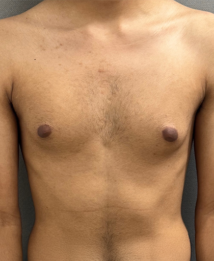 1094-20 Before Image