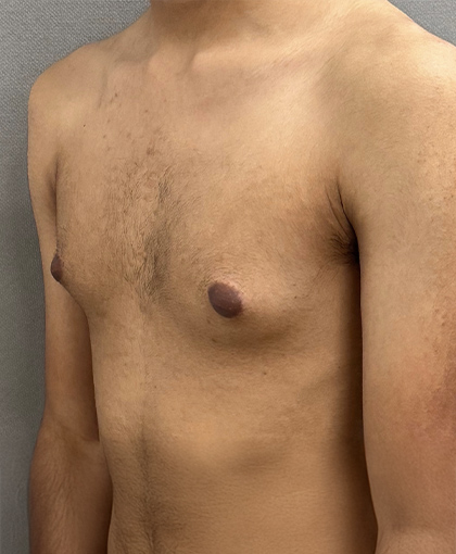 1094-20 Before Image