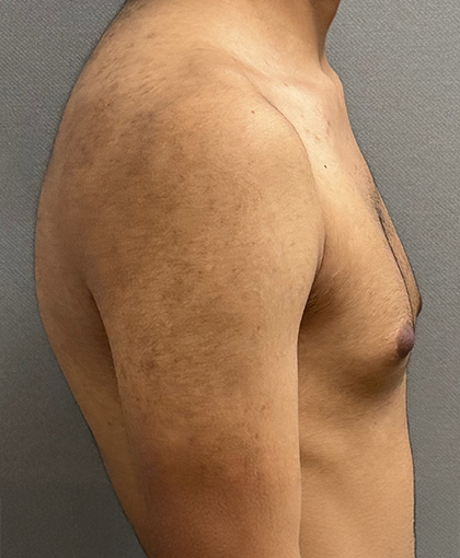 1094-20 Before Image