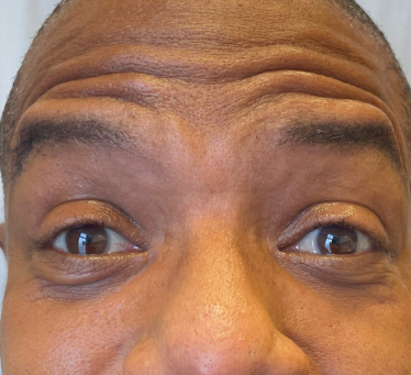 3721 Before Image